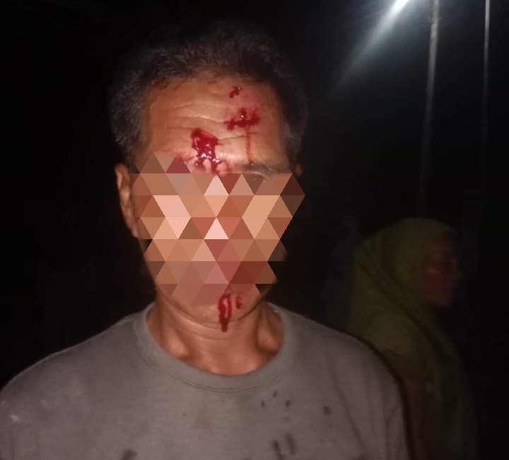 Udin (50) tahun Korban Pengeroyokan di yang Dilakukan Dua Pemuda. (Adhy)