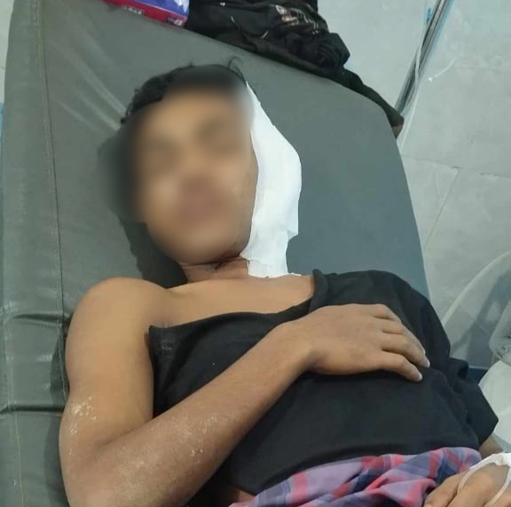 Korban Penganiyaan yang terbaring di Ruang Rawat RSUD Labuha setelah Dianiaya Pelaku (JS)
