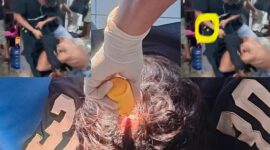 Ket: Kondisi Korban Saat Mendapat Perawatan Medis