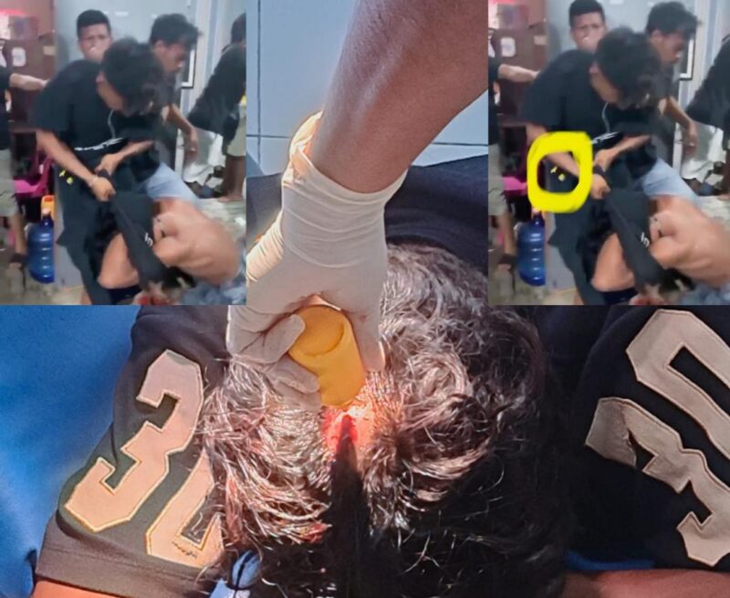 Ket: Kondisi Korban Saat Mendapat Perawatan Medis