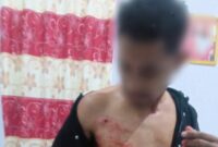 Ket:foto korban Penembakan OTK.
