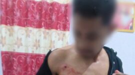 Ket:foto korban Penembakan OTK.
