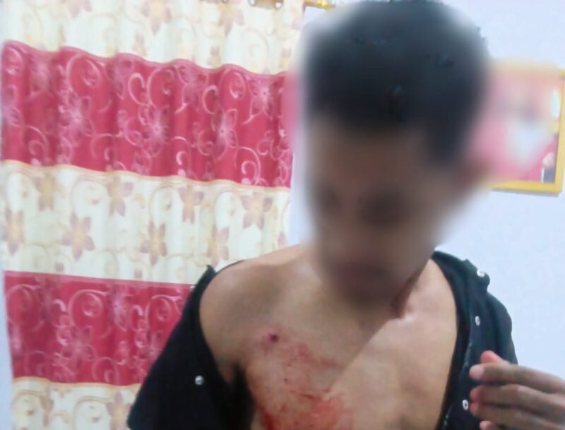 Ket:foto korban Penembakan OTK.