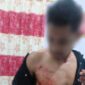 Ket:foto korban Penembakan OTK.